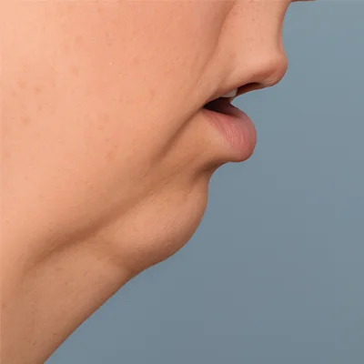 inscription 8bd696588b97b12fa53d5347a13d2ff96b95006e4a285f7ee67ecc6982e9a388i0